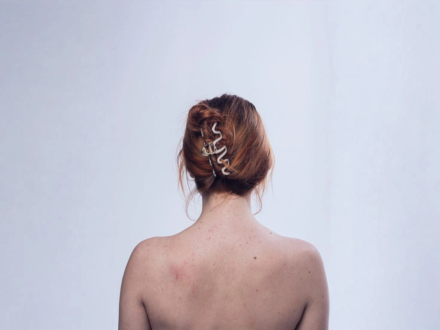 Back of a women suffering form back acne